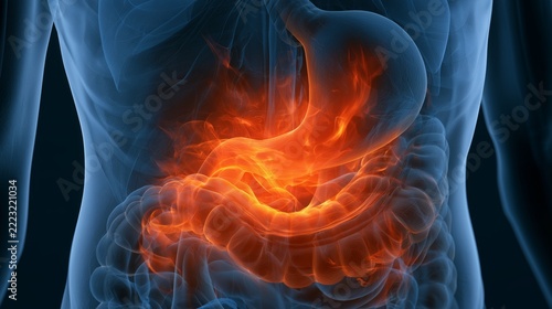 Heartburn causes discomfort in the stomach due to high acidity and irritation of the mucous membrane