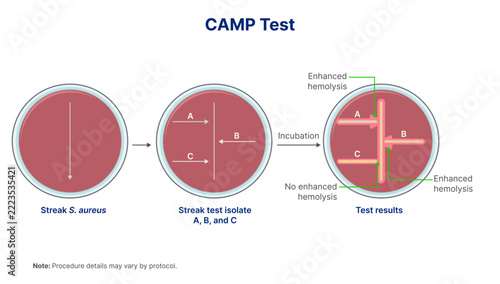 CAMP Test Blood Agar Diagram Showing Enhanced Arrowhead Hemolysis Results