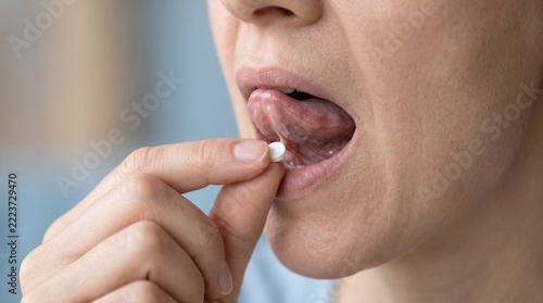 Sublingual GTN Administration