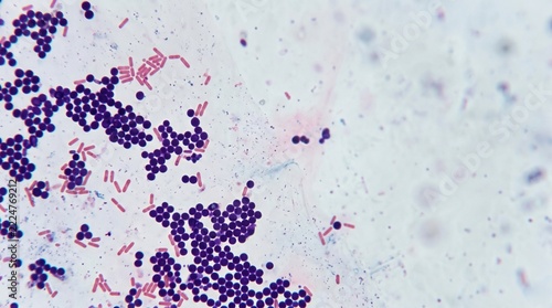 Microscopic view of bacteria with purple and pink coloration in laboratory setting. Bacterial cells showcase distinct shapes and arrangements in a scientific context.
