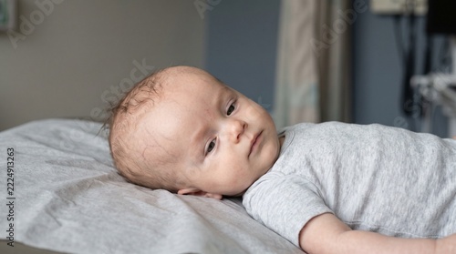 Infant with Hydrocephalus Showing Enlarged Head Circumference