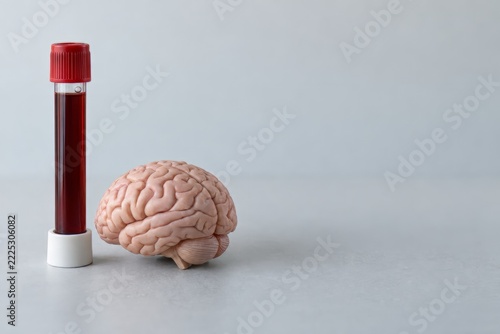 Blood sample tube next to a small anatomical brain model on a bright surface, blood test for Alzheimer's disease concept with copy space