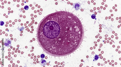 Microscopic view of a large parasite cell surrounded by red and white blood cells science and medical background