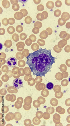 Microscopic view of human blood cells monocytes neutrophils and erythrocytes under magnification Medical science
