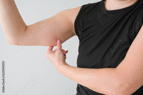 Sagging skin on a woman’s arm against a gray background.