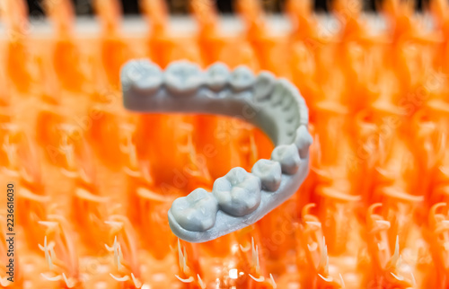 lower jaw of a man created on a 3d printer